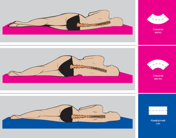 Жесткость матраса влияет не только на качество сна, но и на позвоночник